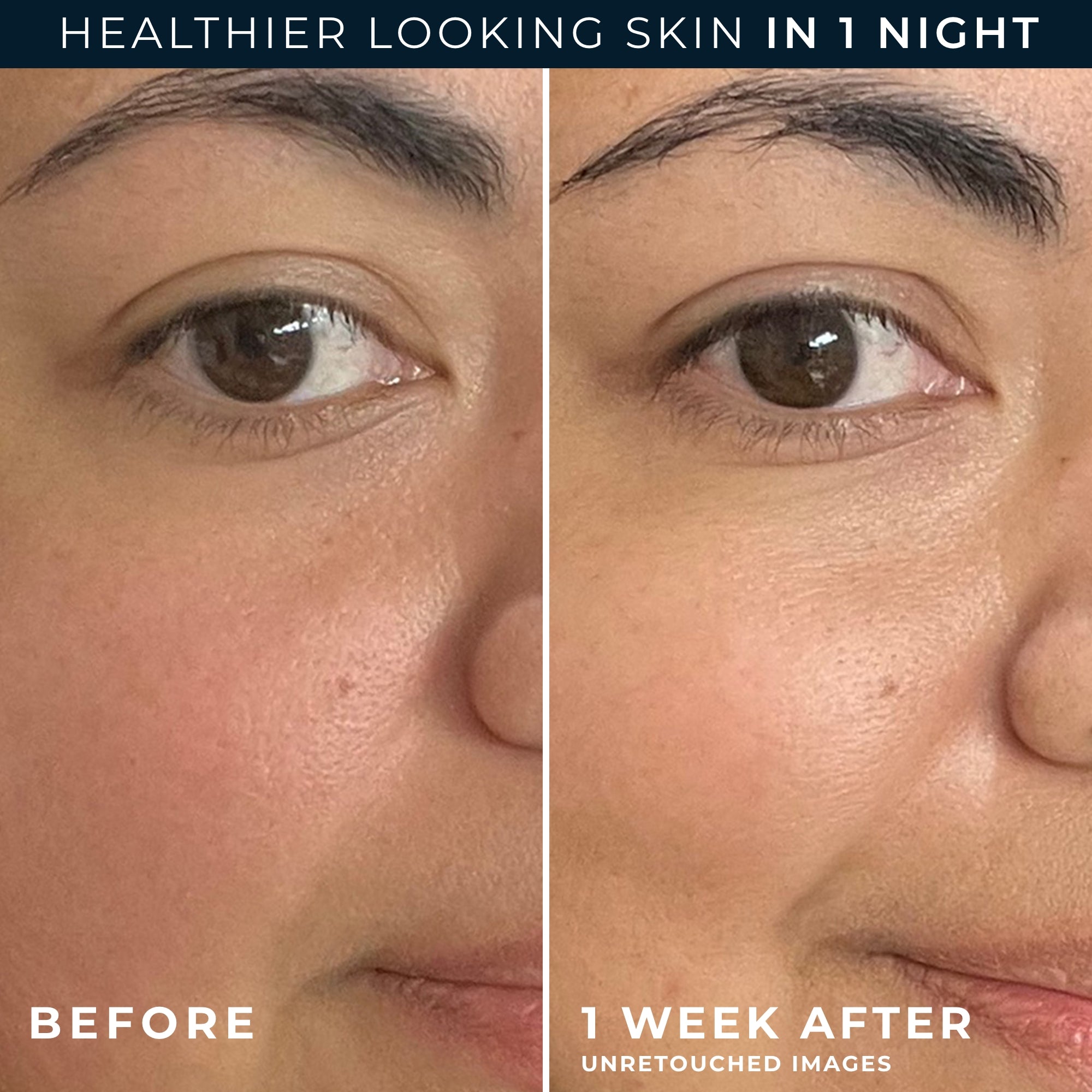 Barrier Renew® PM Moisturizer - Image 5