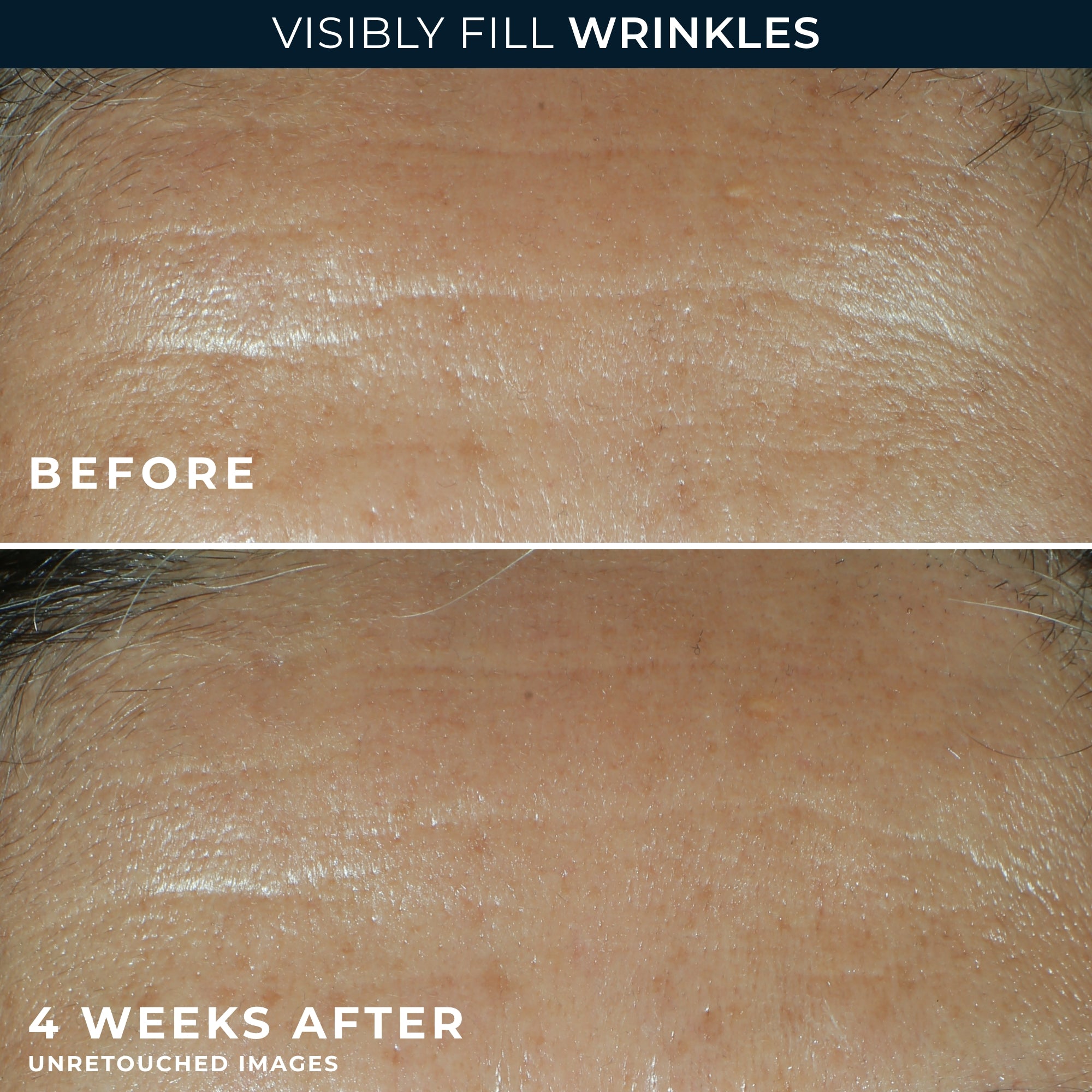 RETINOL CORREXION® Deep Wrinkle Filler - Image 4