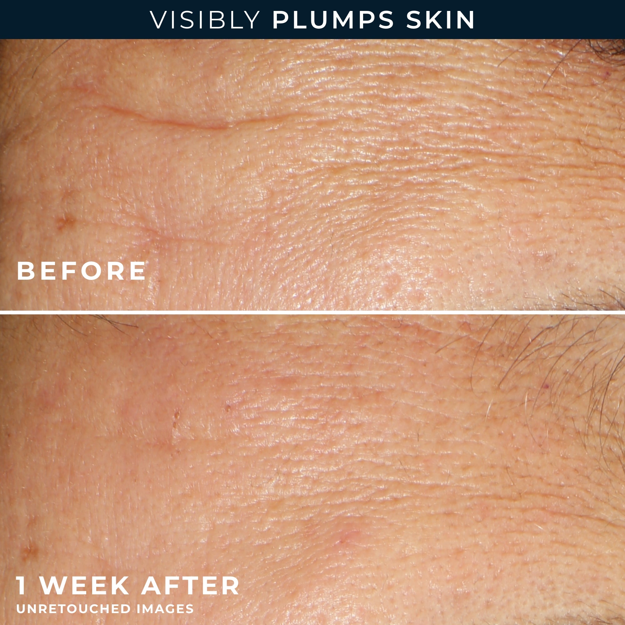 Hydration+ Serum Capsules - Image 4