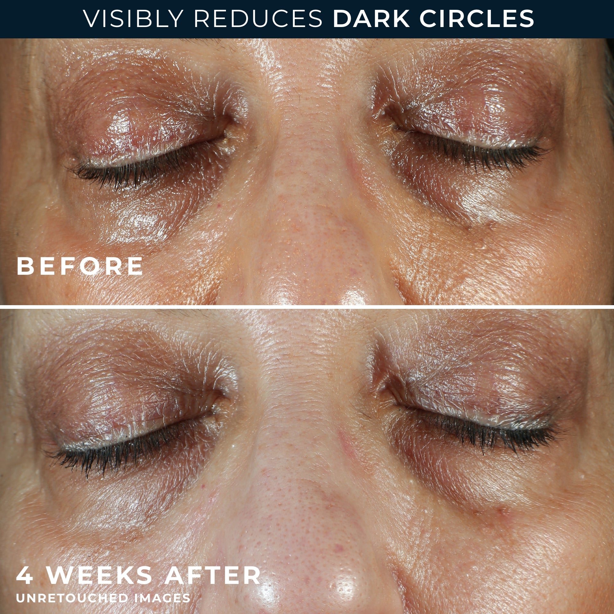 MULTI CORREXION® Even Tone + Lift Eye Cream - Image 5