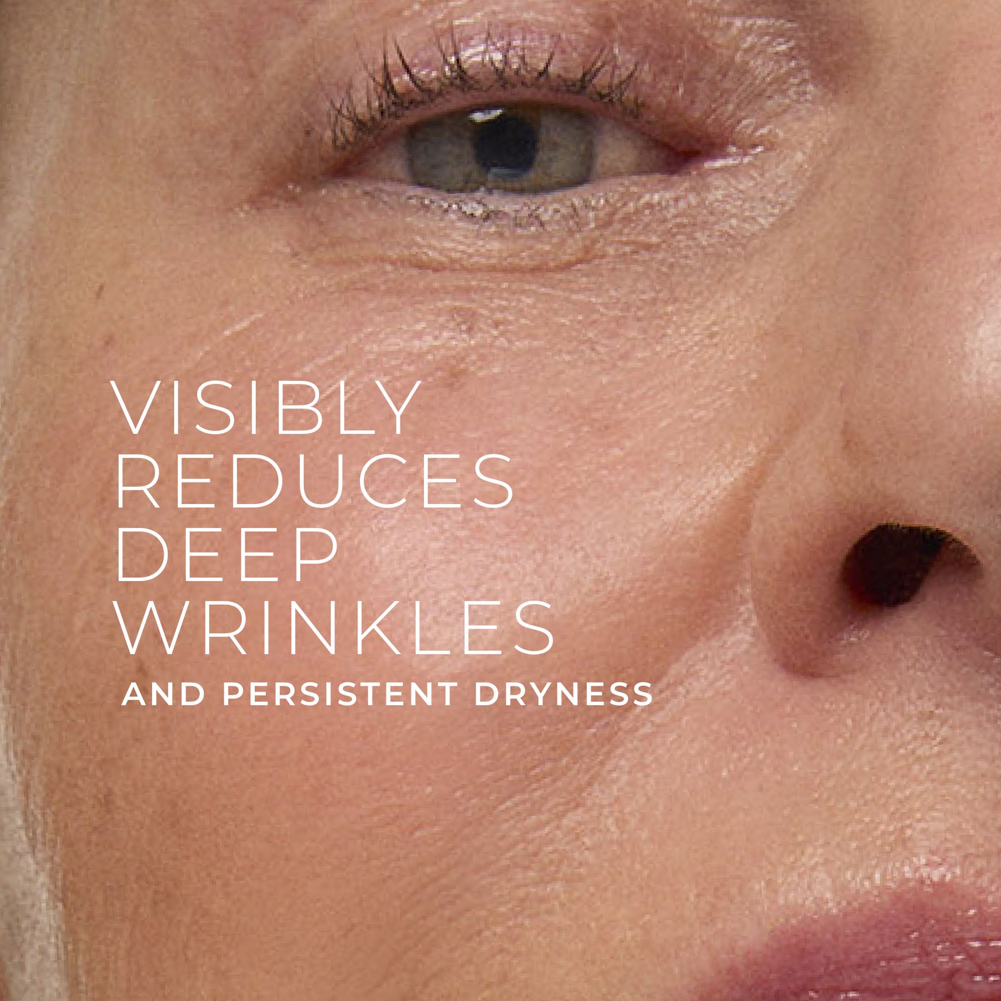 RETINOL CORREXION® Deep Wrinkle Rich Cream - Image 2