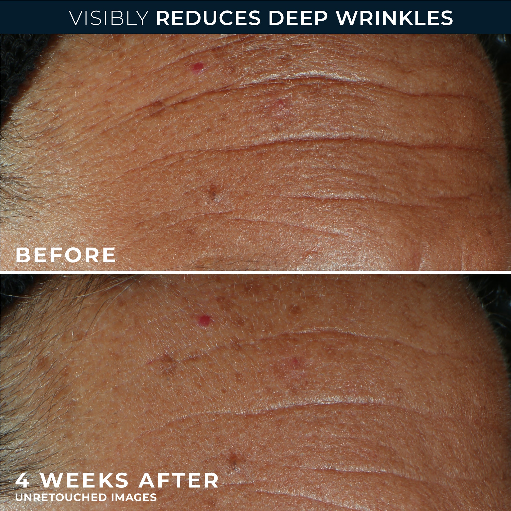 DERM CORREXION® Fill + Treat Serum - Image 5