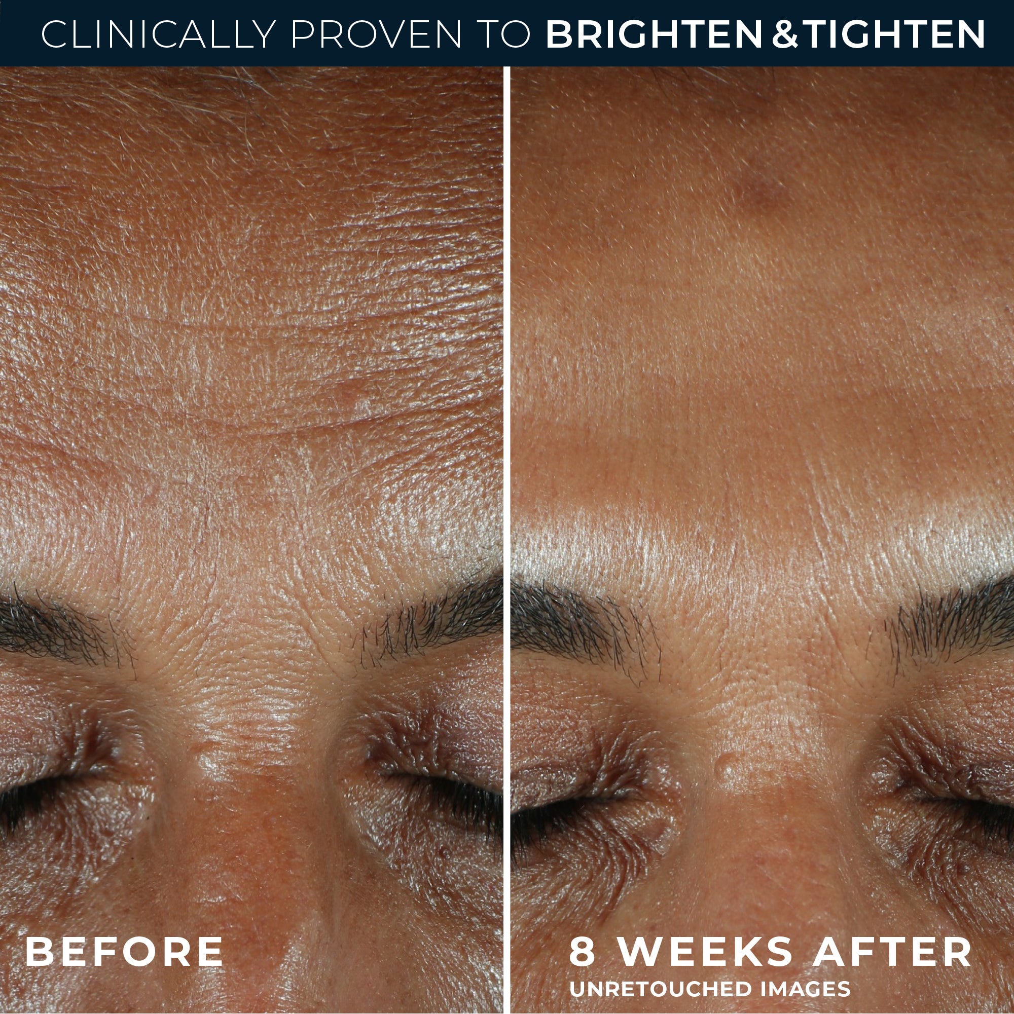 MULTI CORREXION® Revive + Glow Daily Serum - Image 4